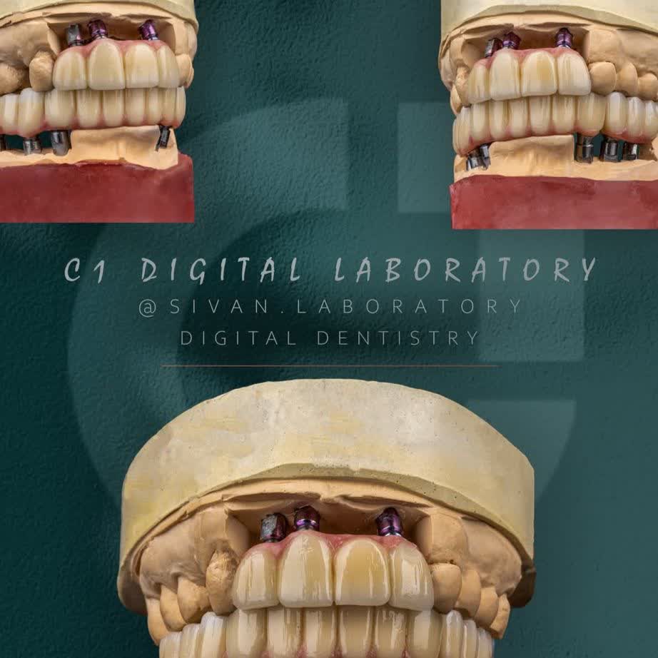 نمونه کار لابراتوار دندانسازی سیوان | مطب ۳۶۵