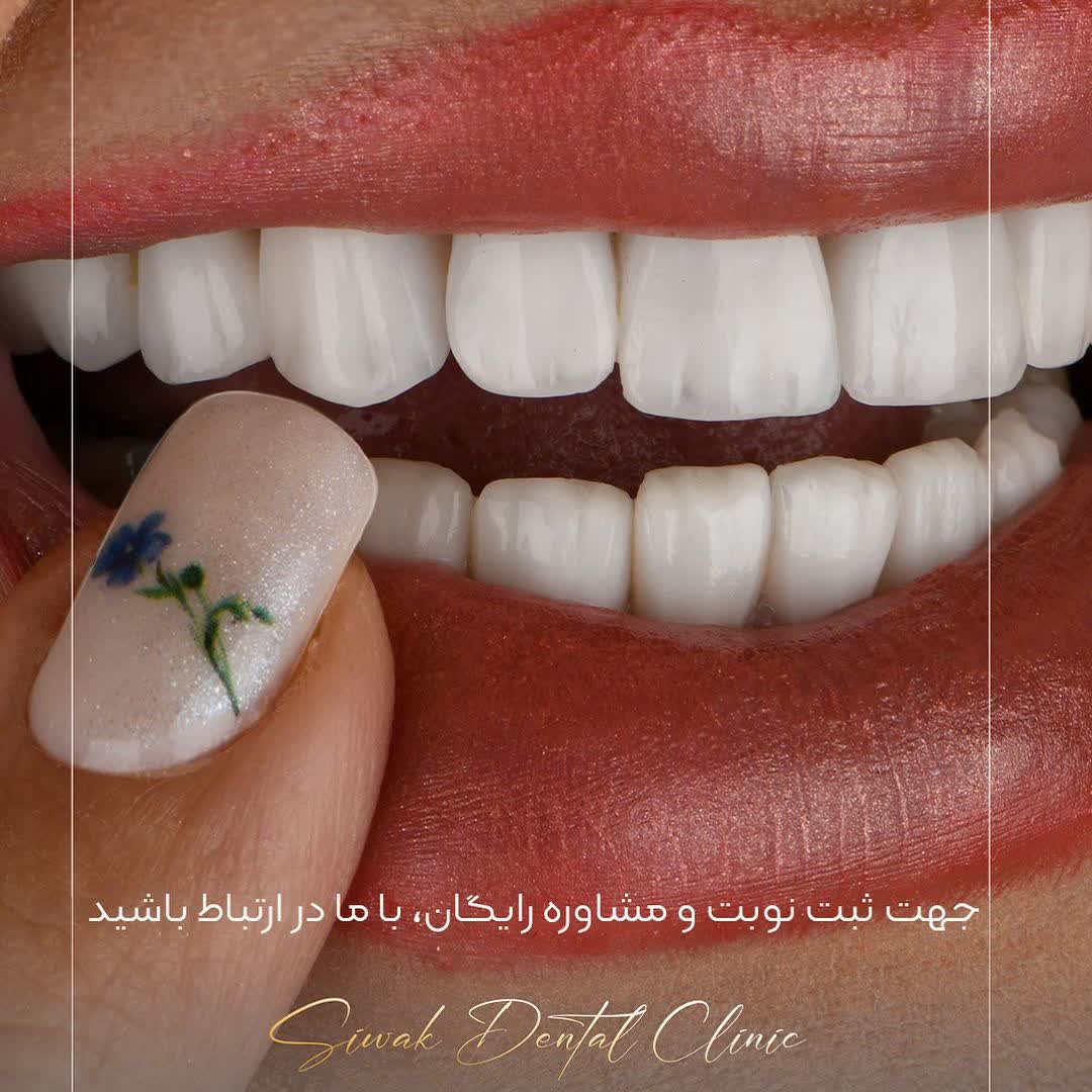نمونه کار لابراتوار دندانسازی سیوان | مطب ۳۶۵