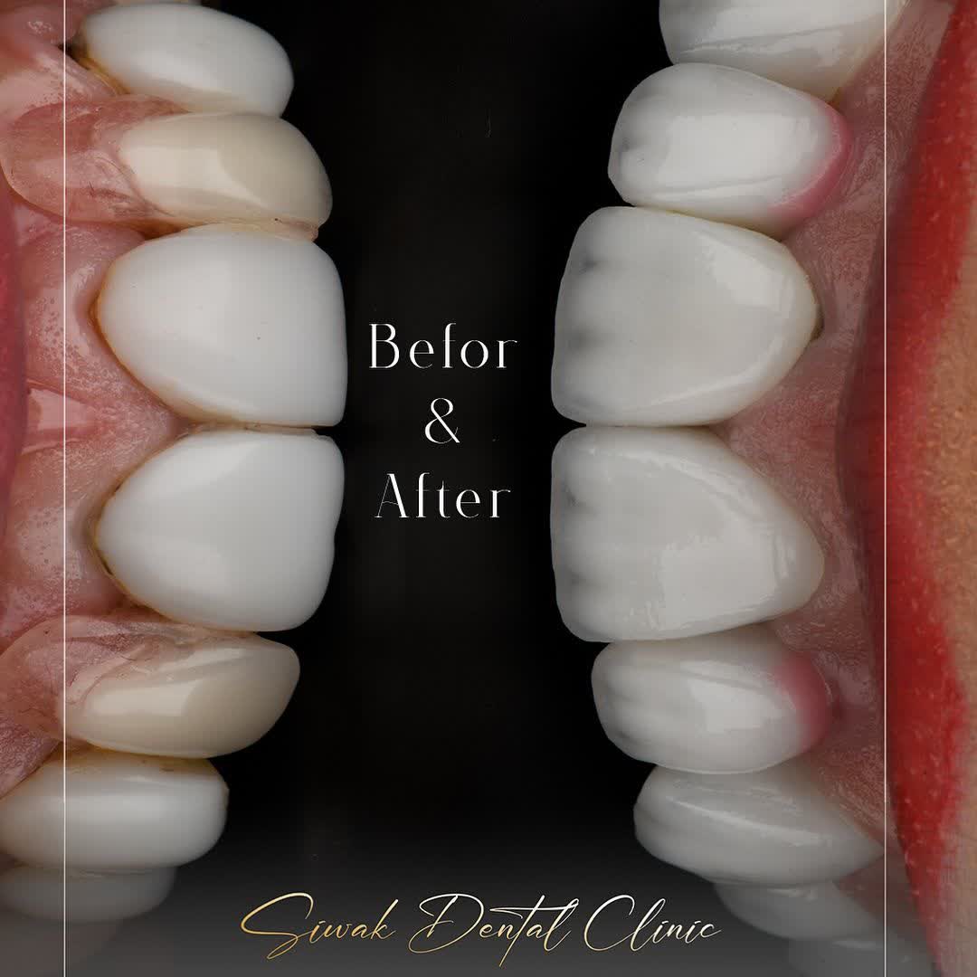 نمونه کار لابراتوار دندانسازی سیوان | مطب ۳۶۵