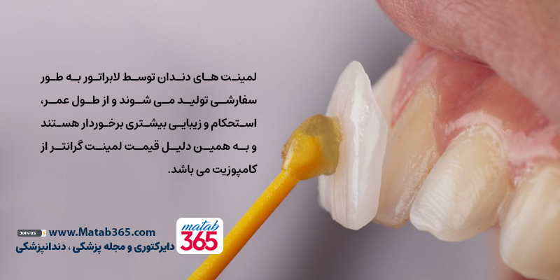 لمینت یا کامپوزیت؟ چرا قیمت‌ها متفاوت است؟ | مطب ۳۶۵