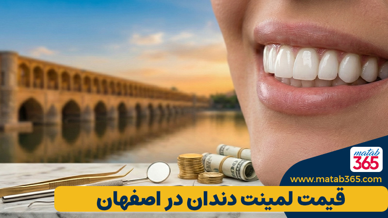 قیمت لمینت دندان در اصفهان؛ لیست تعرفه ۱۴۰۴ و عوامل موثر | مطب ۳۶۵