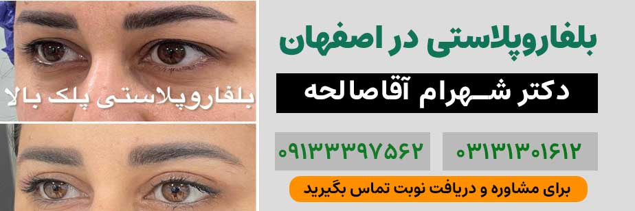 بلفاروپلاستی در اصفهان| دکتر شهرام آقا صالحه