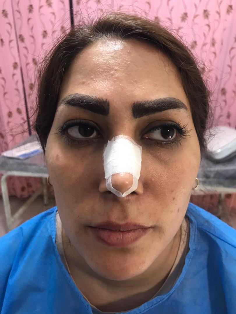 تزریق چربی در اصفهان| دکتر شهرام آقاصالحه