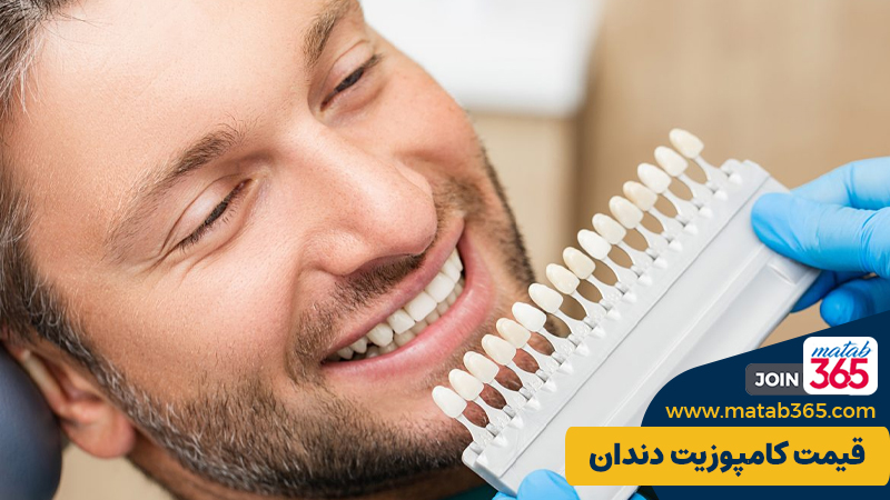 قیمت کامپوزیت دندان در اصفهان
